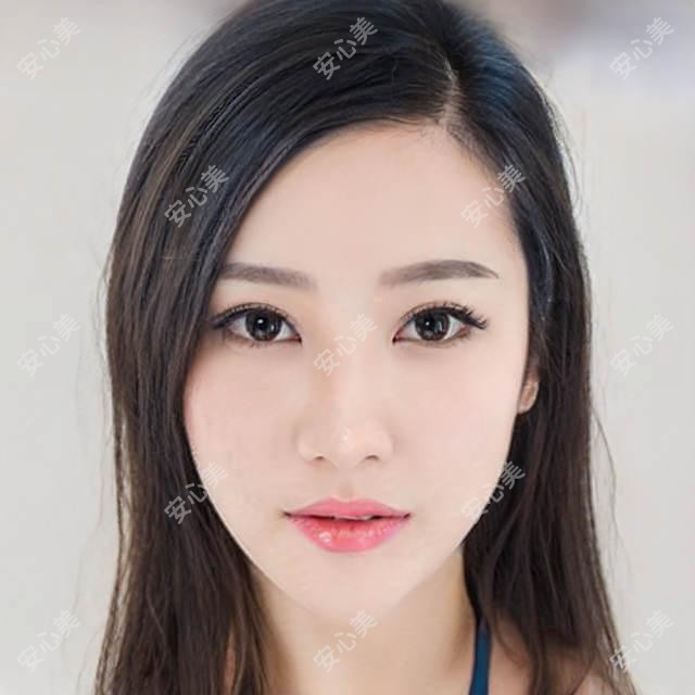 绵阳医美医生排行曝光!韩系微创整形,眼部鼻部微雕受追捧!