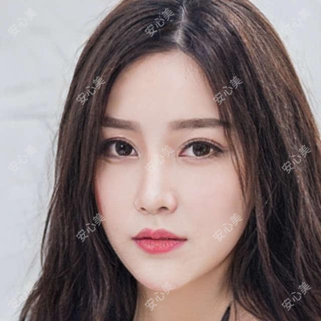 南阳口腔医院姚遥医生牙齿美白测评:30年经验治龋齿疗效自然,美白持久不伤牙