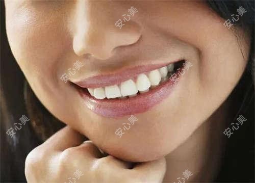 常州微笑唇和M唇哪个更自然 价格和疗效对比解析