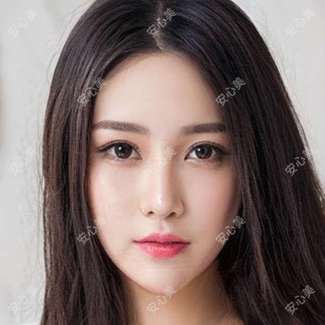 张跃伟医生祛斑除皱疗效如何?擅长分层注射与激光美肤抗衰老