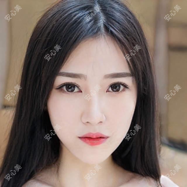 丽水地区口碑医生推荐:胡靖宇与方剑锋的种植牙技术如何?