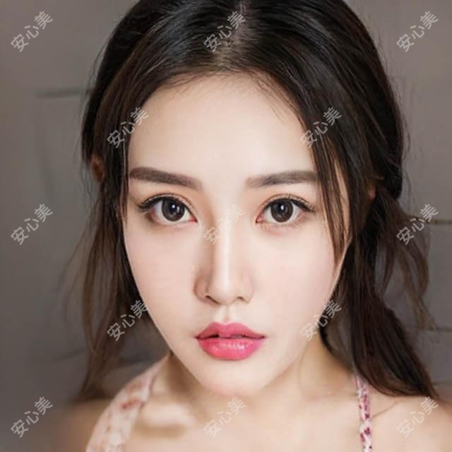 刘育凤整形技术如何?鄂尔多斯百达丽医生眼部鼻部实例解析