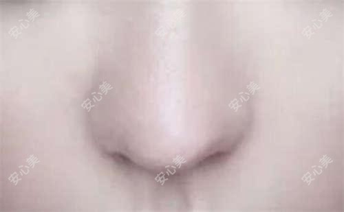 成都美极医美价格揭秘:整形项目5000+皮肤管理2000+微整1800元起实惠之选