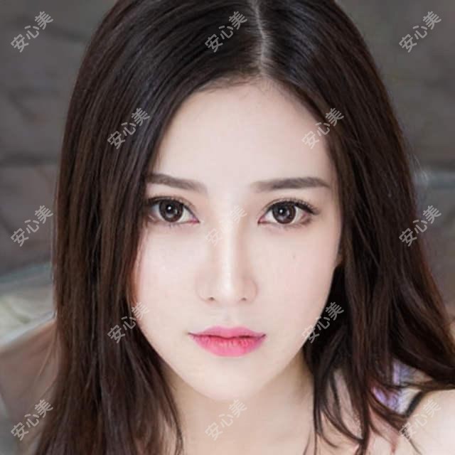 天津熙朵植发2023全项目价格公开:发际线调整/头顶加密/眉毛种植/鬓角修复8800-38000元不等!