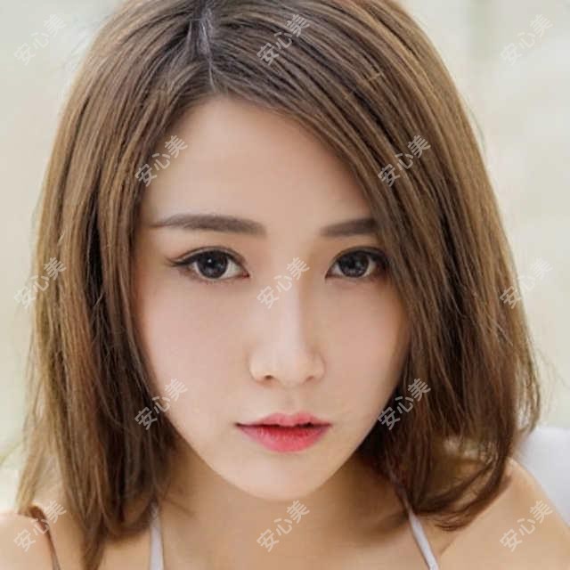 成都友谊医院疤痕科靠谱吗?点阵激光祛疤3800起,手术切除疤痕6800元