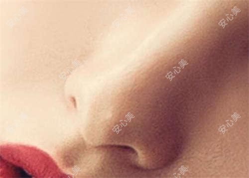 2025武汉月目医美项目价格表:生长因子取出、面部微雕等热门项目费用公开!