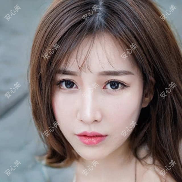 吉林市幼态脸项目1w左右体验分享：紧致提升疗效明显，但维持期有点短