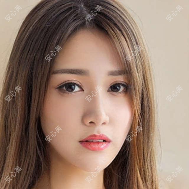 成都瞳仁视康眼科2023全项目价格揭晓:近视矫正/白内障手术/青光眼治疗低至888元起!