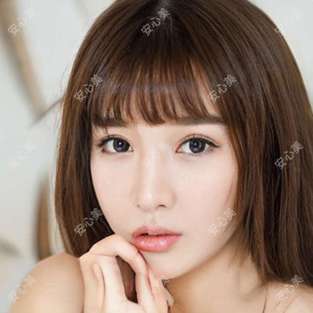 玻尿酸丰面颊:6800元疗效如何?成都这几家医院口碑不错!