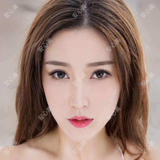 肉欲唇：3980元值不值？北京靠谱医美机构肉欲唇项目体验分享！