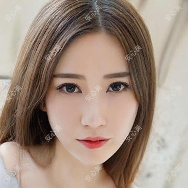 临沂|抗衰紧致必做项目 1.8万起疗效惊艳 30+姐妹都在冲!