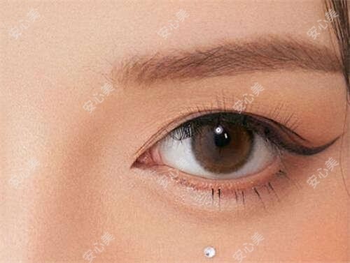 德州人民医院眼科梁玲医生:全飞秒近视手术与白内障手术医生解析