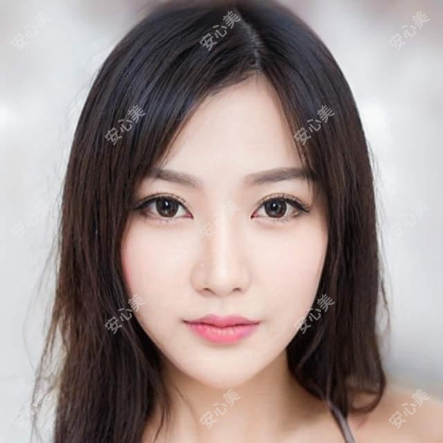 绍兴诸暨京韩口腔刘婷医生：牙齿修复与全瓷牙美学方案
