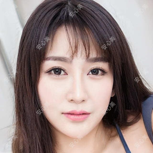 王希华医生丰太阳穴疗效如何？附威海美神医生项目介绍