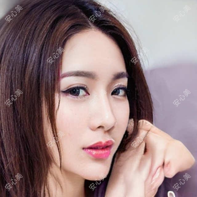 深圳泰禾医美VS瑞美颜:光子嫩肤+热玛吉哪家强?探店实录分享