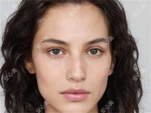 丁庆丰医生做双眼皮和隆鼻怎么样？石家庄雅芳亚整形医生擅长眼鼻修复与面部除皱