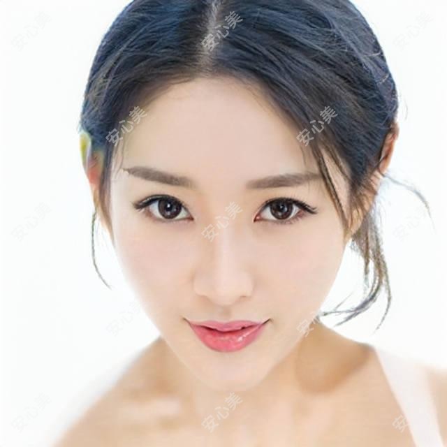 临沂新益民眼科田作龙医生白内障手术测评:超声乳化技术娴熟,晶体置换恢复较快疗效好