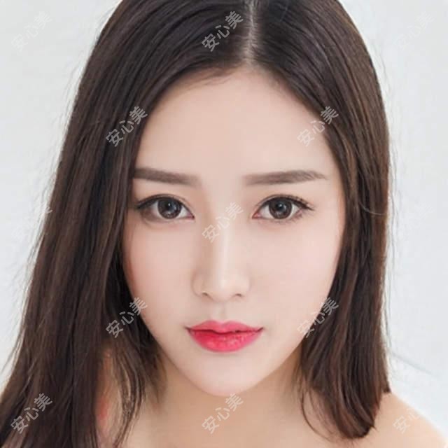 惠州牙齿修复医生推荐，有名医生擅长种植美学修复