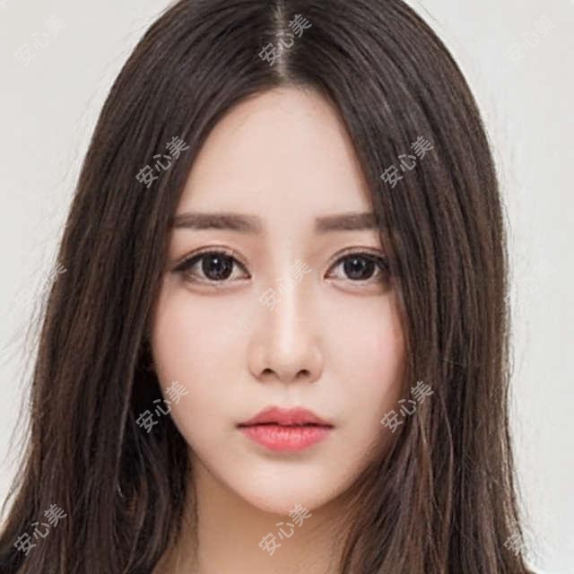 广州高尚医美祛增生疤痕多少钱?点阵激光1280+|疤痕切除2680+|微针修复980+|价格表全公开