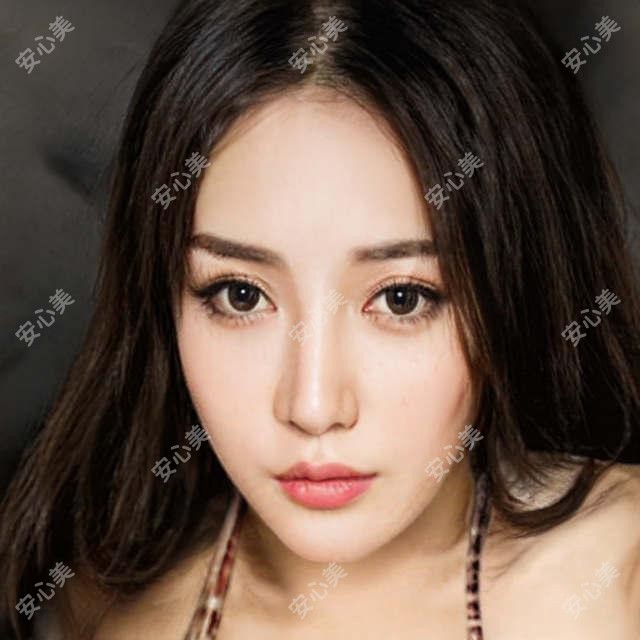 深圳ICX种植牙体验与解析:美佳德12000元 vs 深圳佳文11500元,详解价格及优劣
