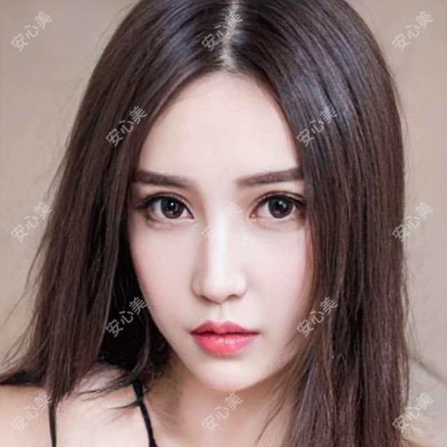 绍兴维美汪峰医生做双眼皮怎么样？技术精细，恢复较快！附实例及预约方式