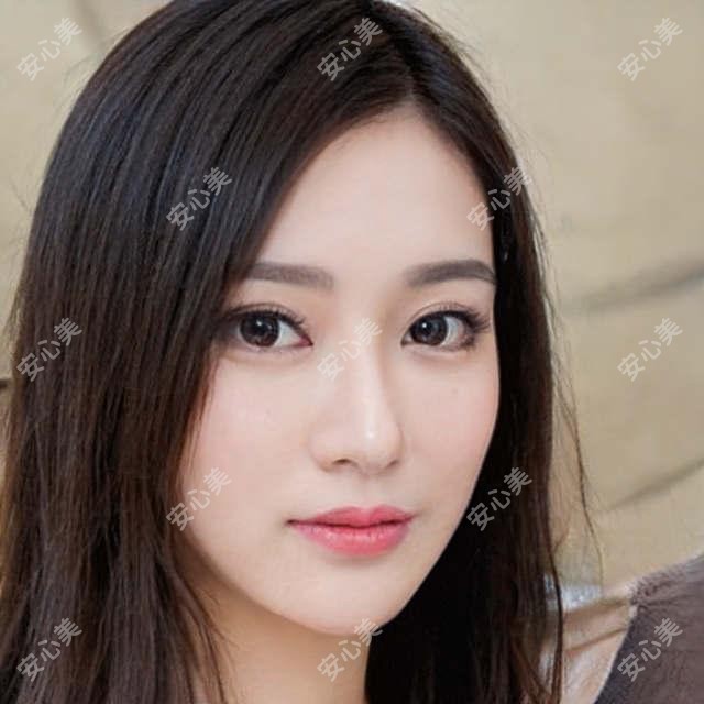 烟台华怡整形孙凤云医生怎么样?面部年轻化医生实力解析!
