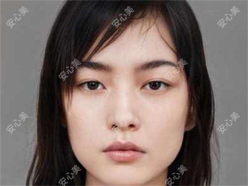 泰州直角肩填充需要多少支玻尿酸 价格与疗效深度解析