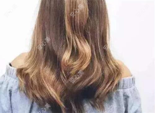 上海丽铂医美价格全公开:热玛吉、玻尿酸、双眼皮项目费用一览