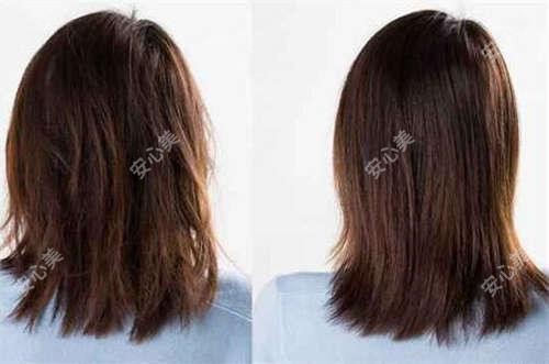 上海新视界东区眼科全项目价格揭晓:近视手术8800起,检查套餐199元起实惠优选