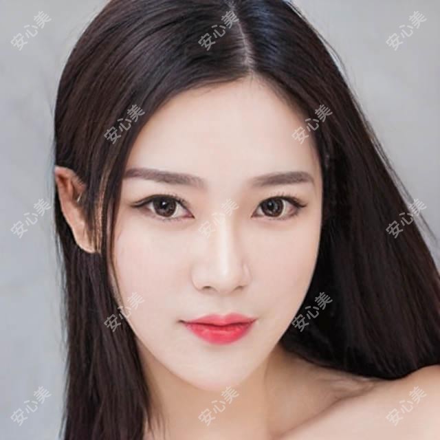 北京市佳美口腔(丹霞店)补牙多少钱?树脂补牙300+/嵌体修复1500+/根管治疗2000+