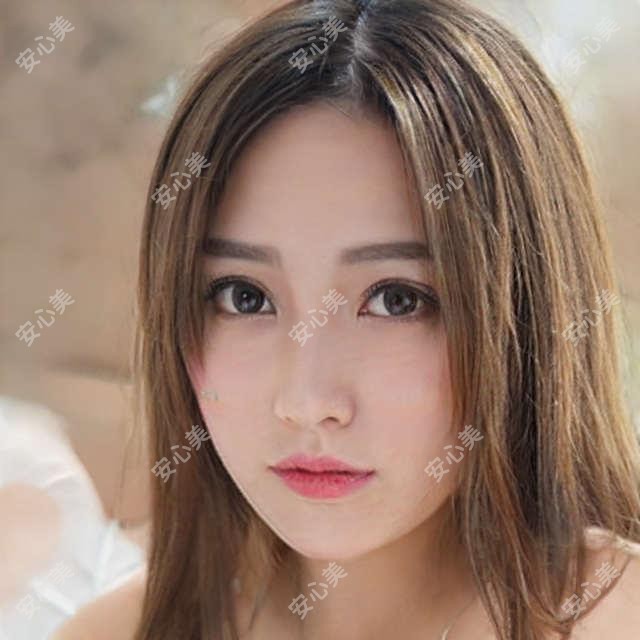 温州方爱武医生解析青光眼治疗费用与手术方案|温州眼视光医院医生