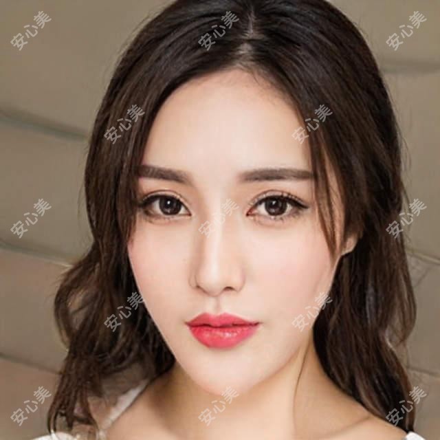合肥德国阿玛仕1050rs半飞秒激光价格多少钱？2025收费表：德国蔡司微雕C+半飞秒1.8w元起、德国蔡司半飞秒激光1.8w元起
