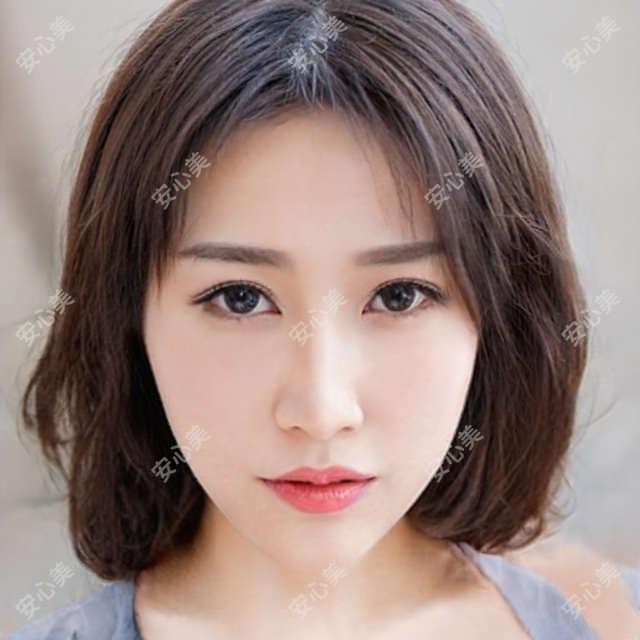 保定眼科医生排行揭晓!张月玲、曹经栋擅长眼疾诊疗及整形!