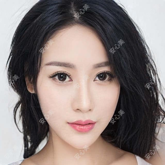 重庆美国CRT定制片角膜塑形镜一般多少钱?4798元可做,术前指南教你不被坑