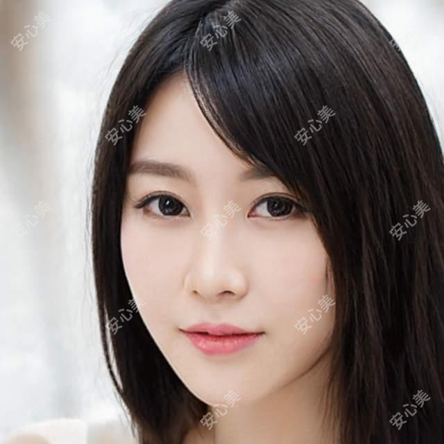 九江爱尔眼科谭桂英医生:全飞秒近视手术医生,浔阳区激光矫正实例丰富