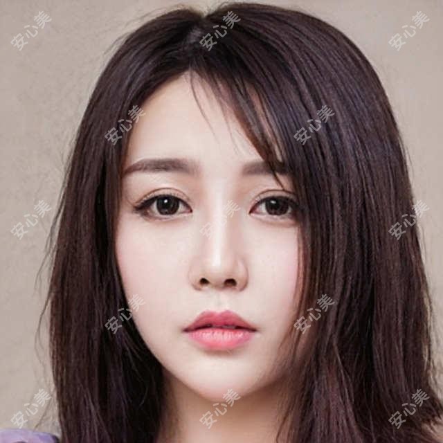 M唇塑形:枣庄市做一次要3680元?这家医院的自然妈生款M唇太绝了!