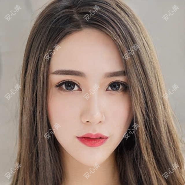 裴付彬眼科医生-沧州献县众明眼科医院裴付彬融合诊疗青光眼白内障口碑优