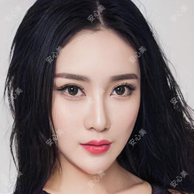 上海爱尚丽格医美门诊2023项目价格大全:眼部整形8800+|鼻部综合塑形15000+|皮肤美容套餐6800+