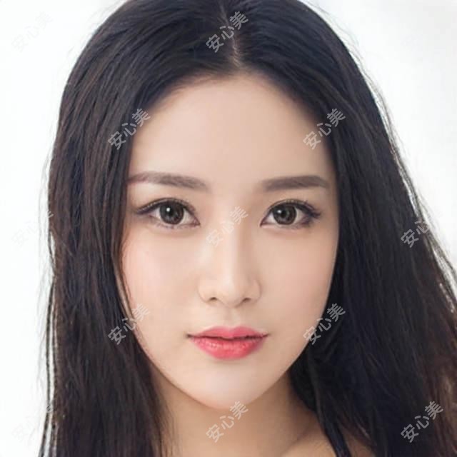 枣庄精灵耳手术多少钱?附5家靠谱医院价格表+真人实例分享