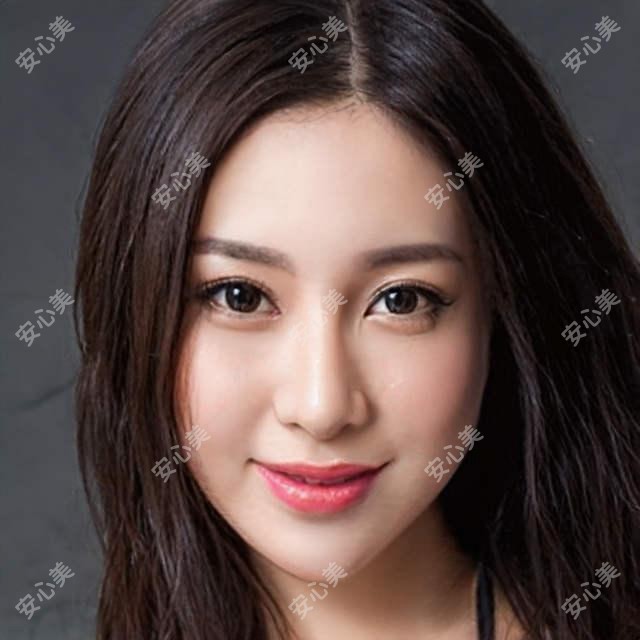 广州荔医医疗美容脂肪丰唇多少钱?玻尿酸丰唇3K+/自体脂肪丰唇8K+/胶原蛋白丰唇5K+