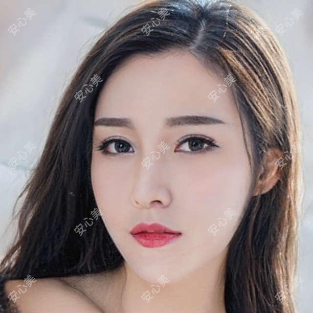 广州康晶眼科项目价格揭秘!2025全新报价表,近视手术8800元起