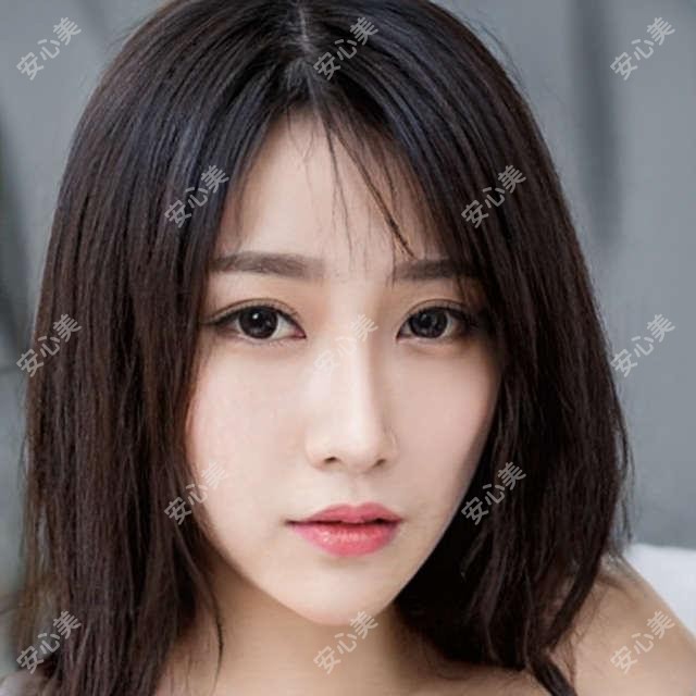 邯郸闫文涛医生做种植牙怎么样?她在贝洁口腔的技术优势有哪些?