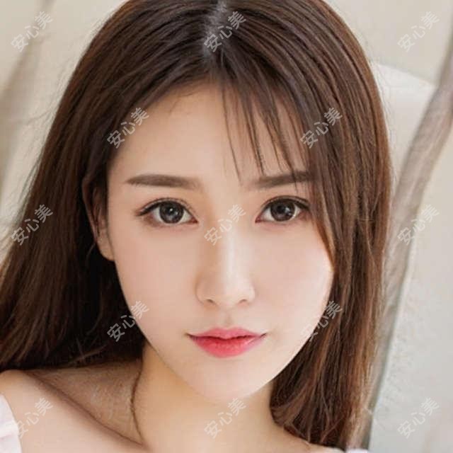 北京紫洁眼袋双眼皮医院实惠 眼袋去除+双眼皮成形 全项目仅需8888元起