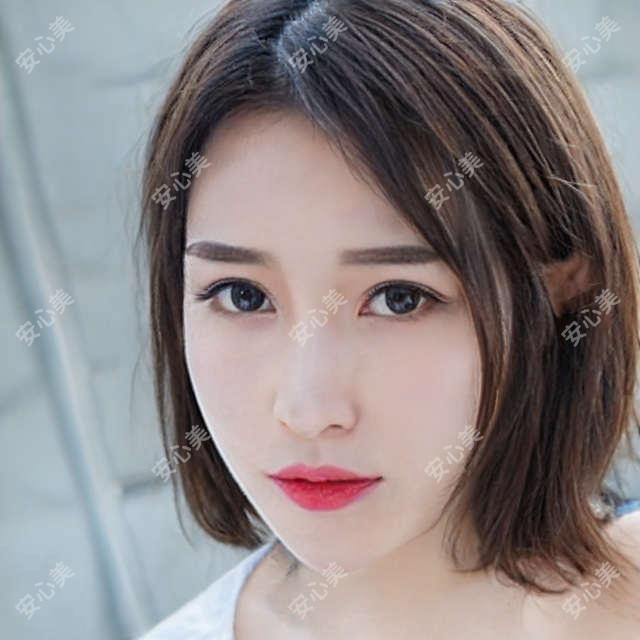 深圳悦尔医美植发专科 热门项目如植发9800元起 双眼皮6800元实惠
