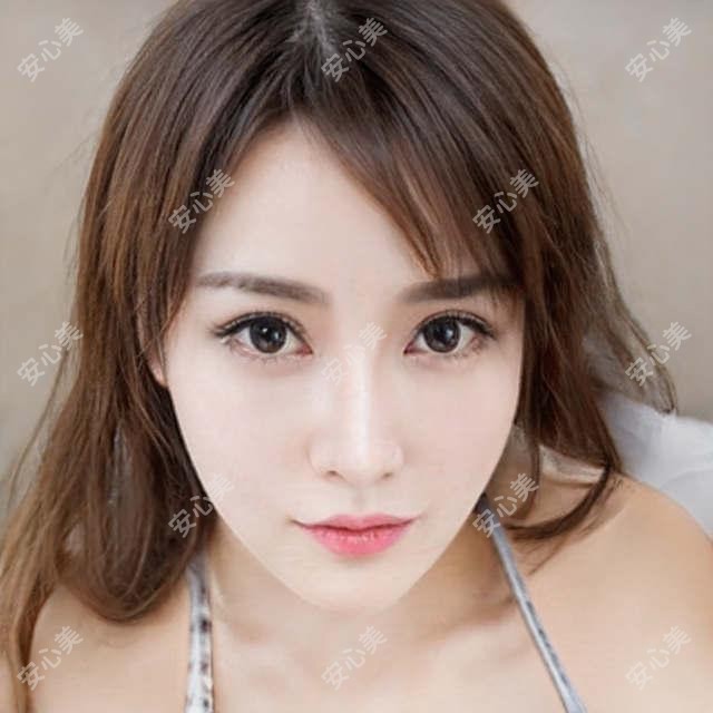 台州国内视达佳数字定制片(DGS)角膜塑形镜一般多少钱?国内视达佳智慧散光片(SA)角膜塑形镜6400元左右