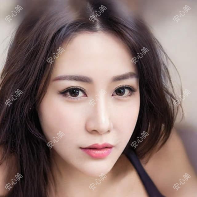 成都华美黑金超光子体验分享 价格疗效与项目优势全解析