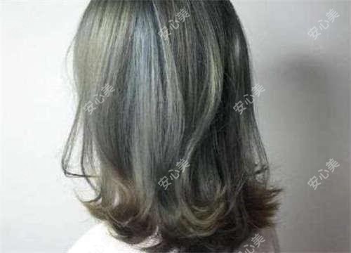 菏泽割双眼皮多少钱？2025年详细割双眼皮价目单