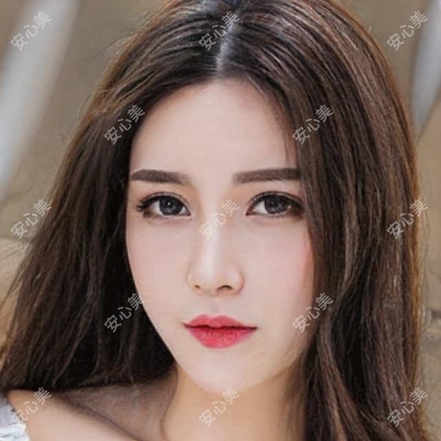 广美医美价格全公开!广州地区双眼皮、玻尿酸项目费用一览