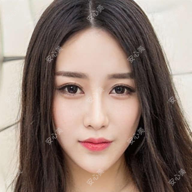 深圳卧蚕填充价格表大公开!附靠谱医院推荐,避坑指南看这篇