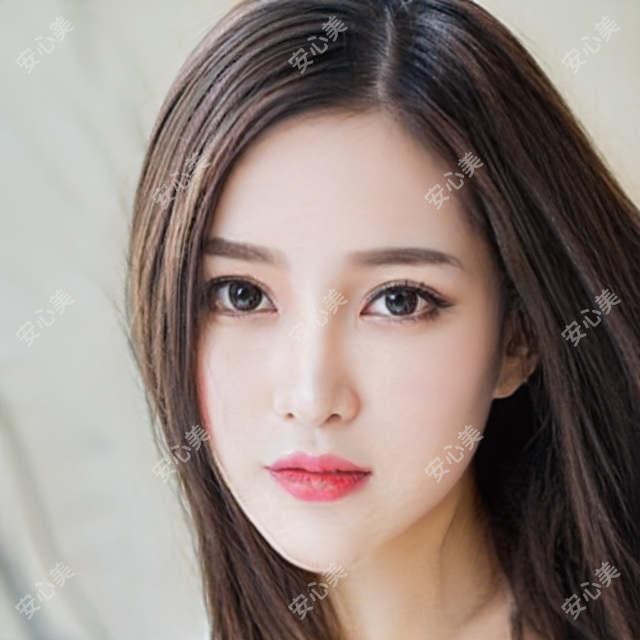 刘文先医生面部年轻化技术如何?柳州华美皮肤美容院长实例解析